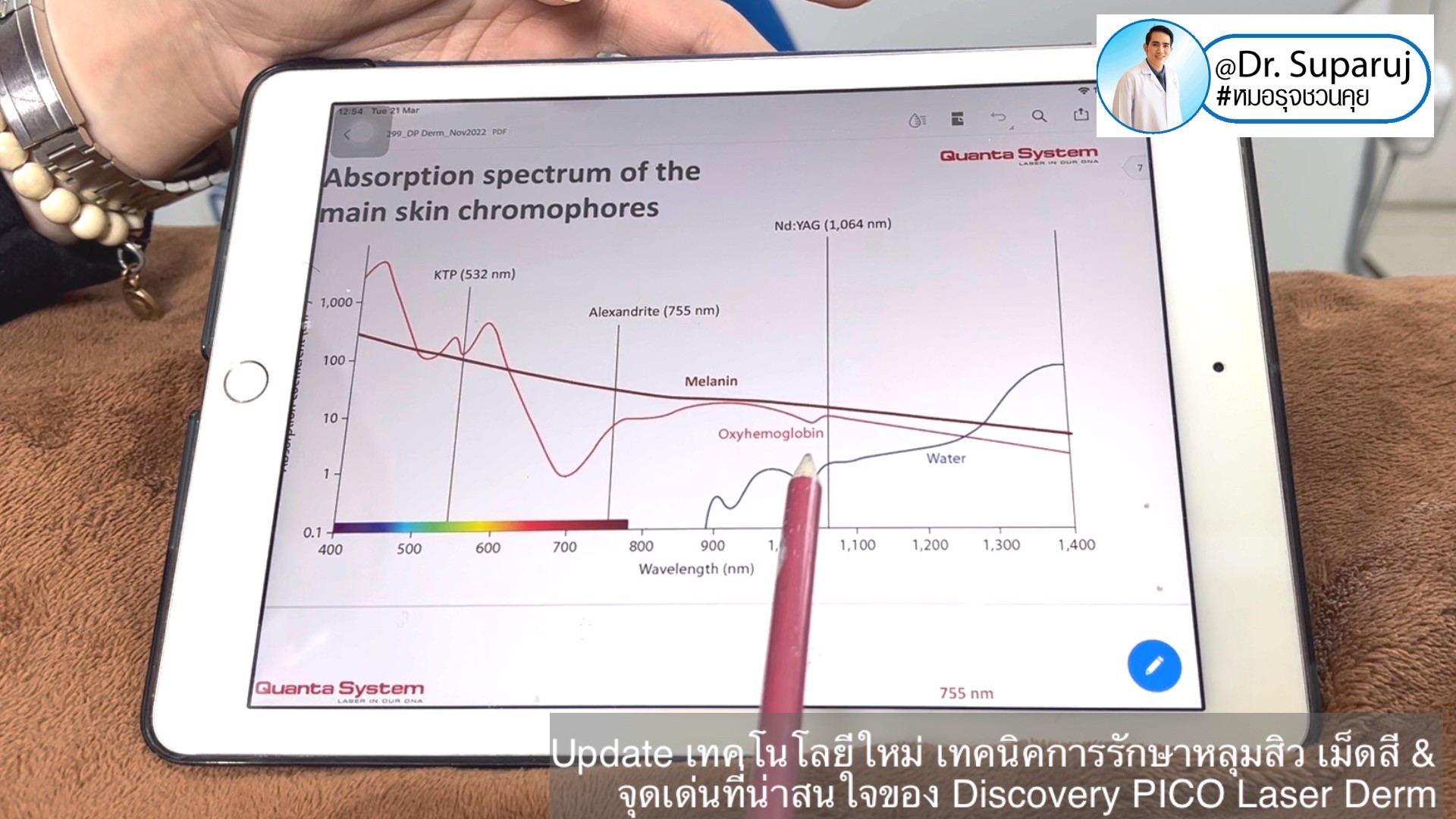 Update เทคโนโลยีใหม่ เทคนิคการรักษาหลุมสิว เม็ดสี & จุดเด่นที่น่าสนใจของ Discovery PICO Laser Derm