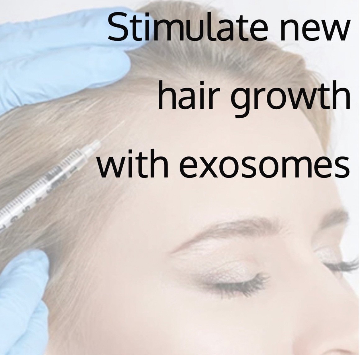 แนะนำเทคนิคดูแลปัญหาผมร่วงผมบาง: Exosome เอ็กโซโซม ช่วยดูแลผมร่วงผมบางได้อย่างไร? แนะนำเทคนิคดูแลปัญหาผมร่วงผมบาง: Exosome เอ็กโซโซม ช่วยดูแลผมร่วงผมบางได้อย่างไร?