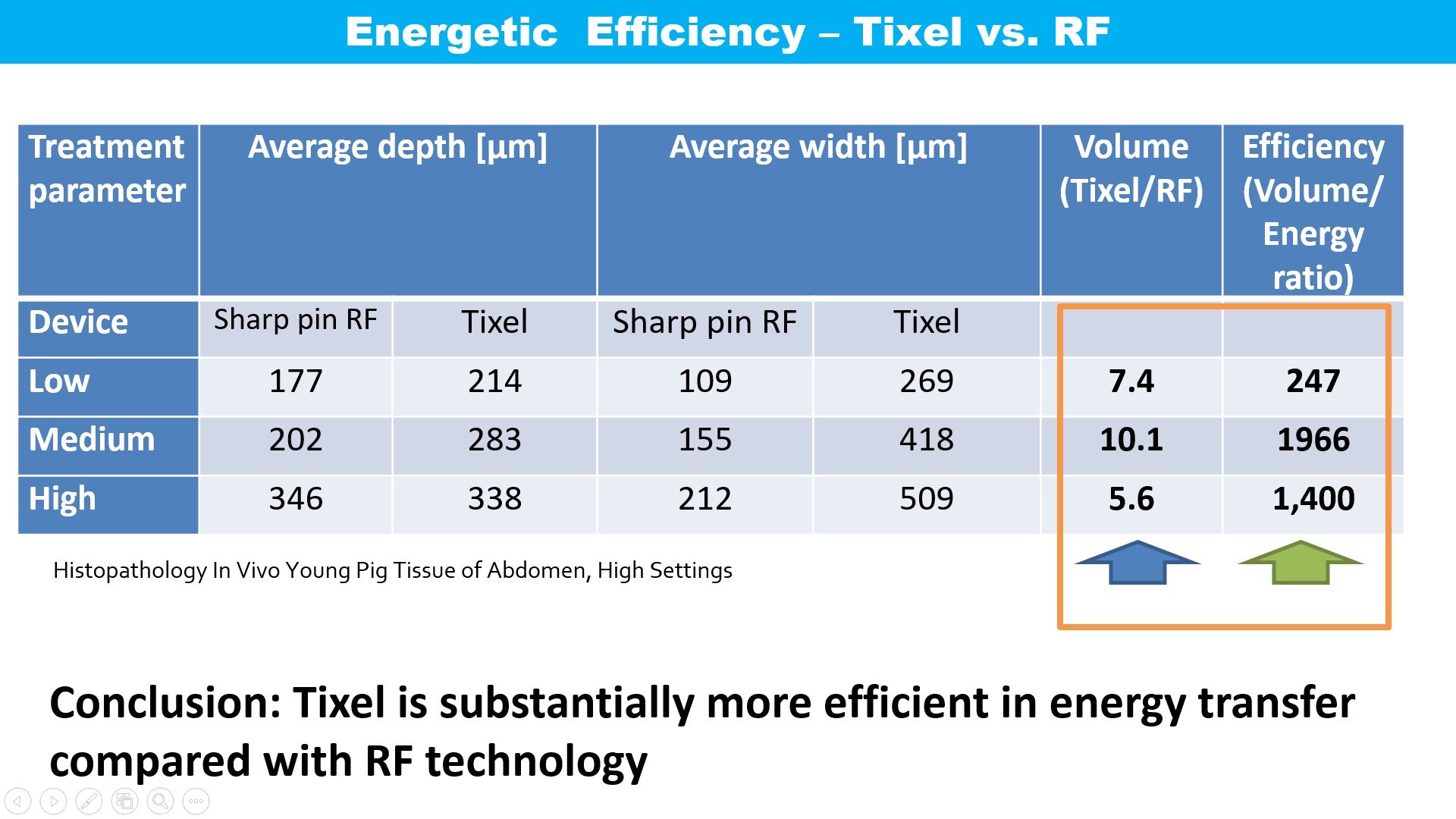 Update เทคนิครักษาหลุมสิว: Tixel ทิ๊กเซลล์ รักษาหลุมสิว ริ้วรอย แผลเป็น เพิ่มการดูดซึมยาด้วยเทคนิค TMA = Thermo-mechanical Abaltion Update เทคนิครักษาหลุมสิว: Tixel ทิ๊กเซลล์ รักษาหลุมสิว ริ้วรอย แผลเป็น เพิ่มการดูดซึมยาด้วยเทคนิค TMA = Thermo-mechanical Abaltion