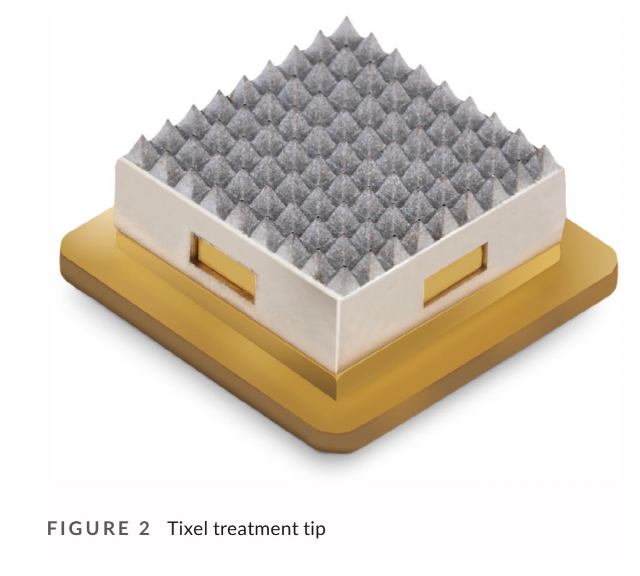 แนะนำเทคนิครักษาหลุมสิวและสิวอักเสบ: ประเมินชนิดความรุนแรงหลุมสิว + เทคโนโลยี Tixel ทิกเซล+ Exosomes แนะนำเทคนิครักษาหลุมสิวและสิวอักเสบ: ประเมินชนิดความรุนแรงหลุมสิว + เทคโนโลยี Tixel ทิกเซล+ Exosomes