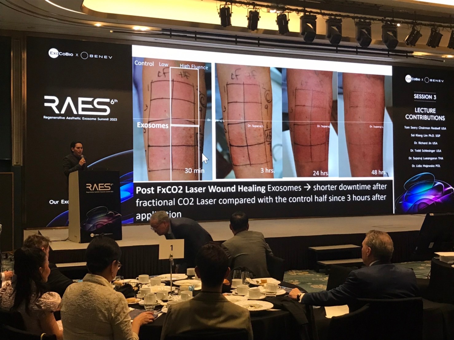 ผู้ช่วยศาสตราจารย์ นายแพทย์ ศุภะรุจ เลื่องอรุณ (หมอรุจ) ได้รับเกียรติร่วมบรรยาย Clinical Aplication of Exosomes และได้รับรางวัล CLINICAL CASE Award ผู้ช่วยศาสตราจารย์ นายแพทย์ ศุภะรุจ เลื่องอรุณ (หมอรุจ) ได้รับเกียรติร่วมบรรยาย Clinical Aplication of Exosomes และได้รับรางวัล CLINICAL CASE Award