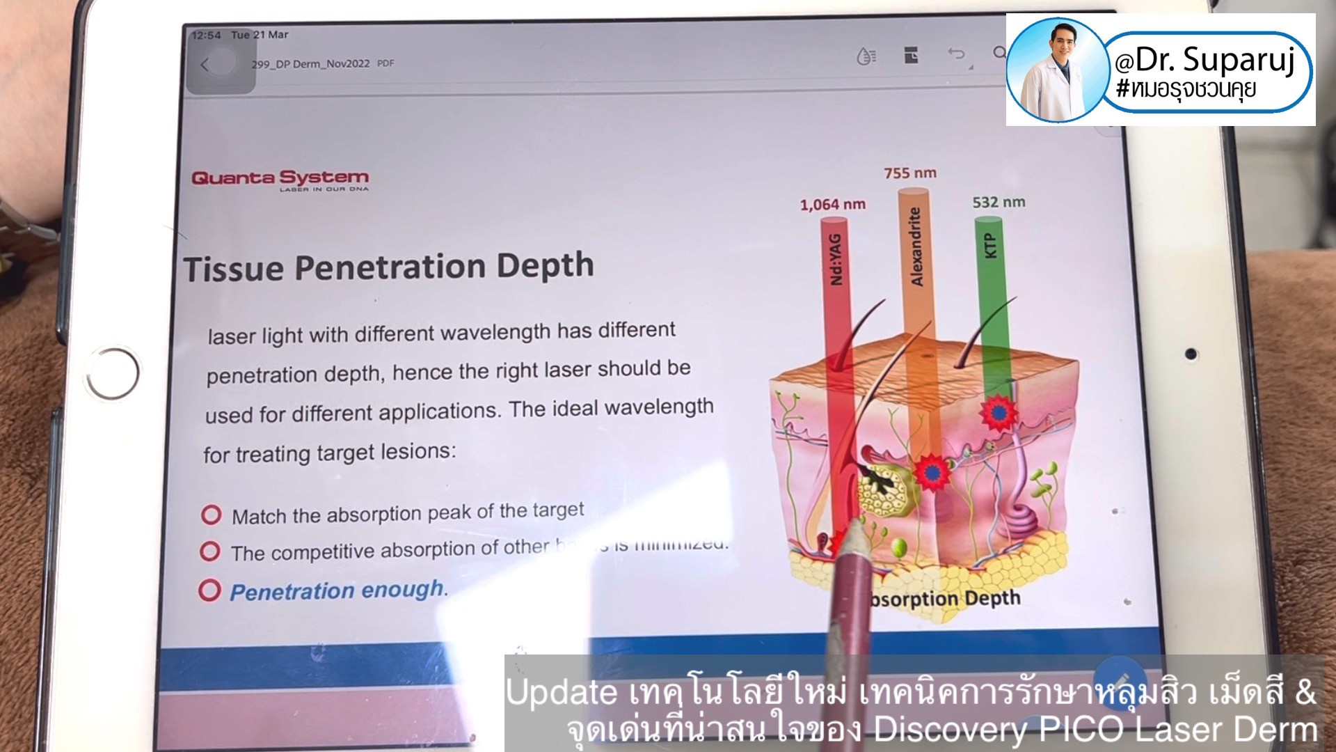 Update เทคโนโลยีใหม่ เทคนิคการรักษาหลุมสิว เม็ดสี & จุดเด่นที่น่าสนใจของ Discovery PICO Laser Derm