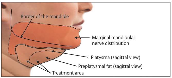 สาเหตุ & เทคนิคลดเหนียง ไขมันใต้คาง คาง 2 ชั้น Double Chin & Submental Fullness Treatment 