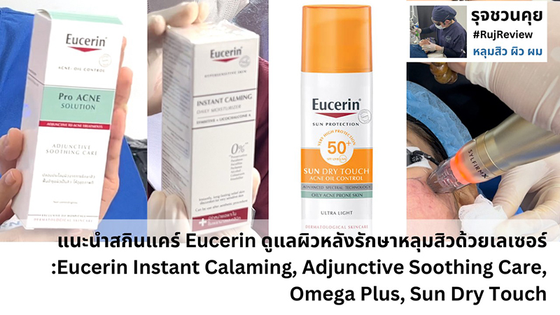 Update & Review เทคนิครักษาหลุมสิว (Acne Scar Treatment: Update & Review) Update & Review เทคนิครักษาหลุมสิว (Acne Scar Treatment: Update & Review)