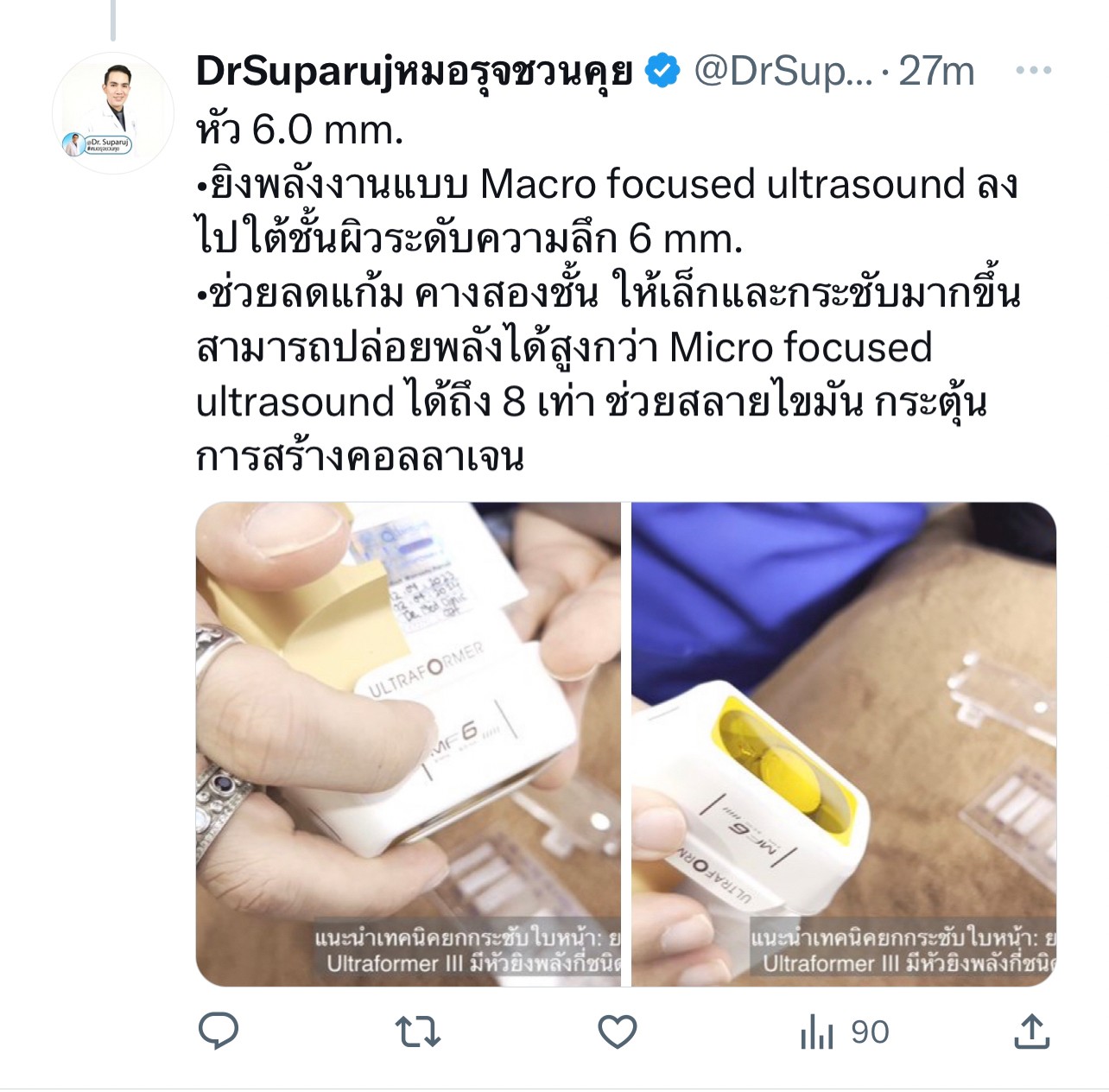 แนะนำเทคนิคยกกระชับใบหน้า: ยกกระชับใบหน้าด้วย Ultraformer III มีหัวยิงพลังกี่ชนิด & ช่วยเรื่องอะไร ? แนะนำเทคนิคยกกระชับใบหน้า: ยกกระชับใบหน้าด้วย Ultraformer III มีหัวยิงพลังกี่ชนิด & ช่วยเรื่องอะไร ?