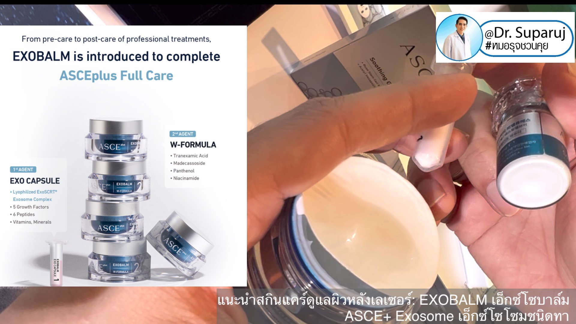 แนะนำสกินแคร์ดูแลผิวหลังเลเซอร์: EXOBALM เอ็กซ์โซบาล์ม ASCE+ Exosome เอ็กซ์โซโซมชนิดทา ดูแลผิวหลังเลเซอร์ ผิวหนังอักเสบ (+ สกินแคร์อื่นๆที่ใช้หลังเลเซอร์ )  แนะนำสกินแคร์ดูแลผิวหลังเลเซอร์: EXOBALM เอ็กซ์โซบาล์ม ASCE+ Exosome เอ็กซ์โซโซมชนิดทา ดูแลผิวหลังเลเซอร์ ผิวหนังอักเสบ (+ สกินแคร์อื่นๆที่ใช้หลังเลเซอร์ )