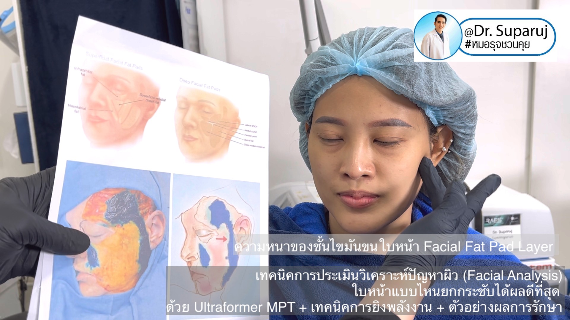 เทคนิคการประเมินวิเคราะห์ปัญหาผิว (Facial Analysis) ใบหน้าแบบไหนยกกระชับได้ผลดีที่สุด ด้วย Ultraformer MPT + เทคนิคการยิงพลังงาน + ตัวอย่างผลการรักษา เทคนิคการประเมินวิเคราะห์ปัญหาผิว (Facial Analysis) ใบหน้าแบบไหนยกกระชับได้ผลดีที่สุด ด้วย Ultraformer MPT + เทคนิคการยิงพลังงาน + ตัวอย่างผลการรักษา