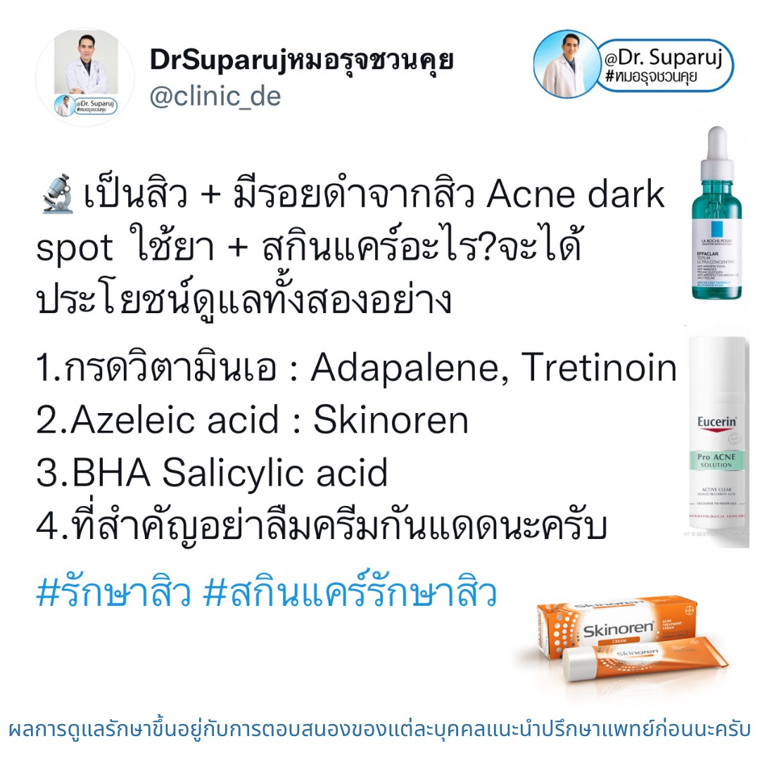 มีปัญหาหลุมสิว แต่ยังมีสิวขึ้นอยู่ สามารถรักษาหลุมสิวได้เลยไหม หรือควรดูแลอย่างไร? มีปัญหาหลุมสิว แต่ยังมีสิวขึ้นอยู่ สามารถรักษาหลุมสิวได้เลยไหม หรือควรดูแลอย่างไร?