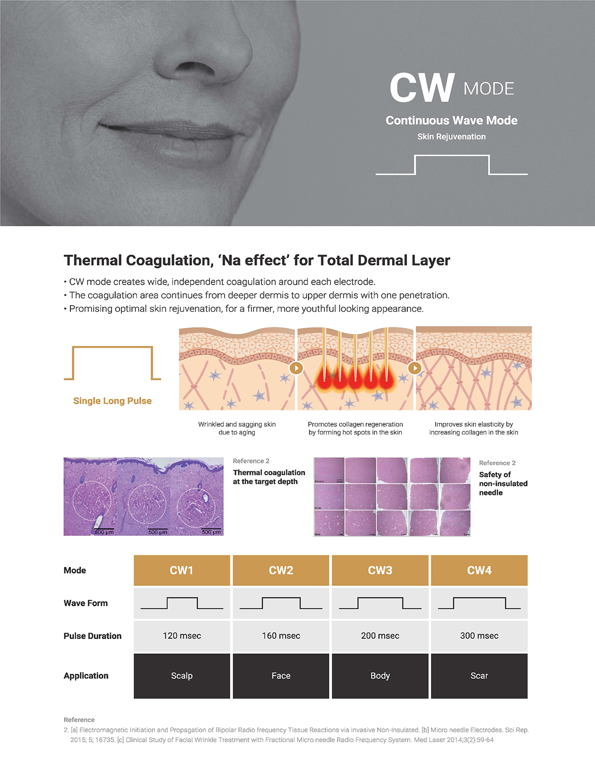 เทคนิครักษาหลุมสิวด้วย SYLFIRM X Plus Fractional RF Microneedle: มีลักษณะพลังงานพิเศษ Pulsed Wave PW Mode + Continous Wave CW Mode เทคนิครักษาหลุมสิวด้วย SYLFIRM X Plus Fractional RF Microneedle: มีลักษณะพลังงานพิเศษ Pulsed Wave PW Mode + Continous Wave CW Mode