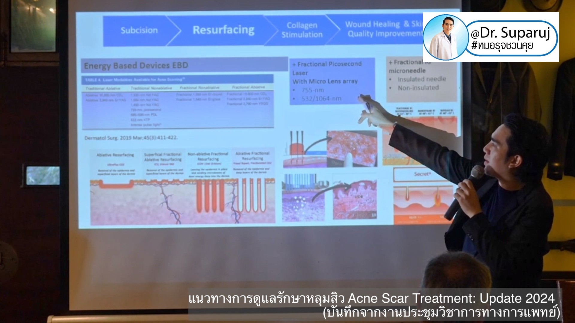 Update แนวทางการดูแลรักษาหลุมสิว Acne Scar Treatment: Update 2024 (บันทึกจากงานประชุมวิชาการทางการแพทย์ครับ) หมอมีบันทึกจากงานประชุมล่าสุดที่หมอได้รับเกียรติเป็นวิทยากรมาฝากกันครัข หมอได้สรุปเทคนิคการรักษาหลุมสิวต่างๆทั้งของเดิมและของใหม่มาฝากกัน อันนี้ตั Update แนวทางการดูแลรักษาหลุมสิว Acne Scar Treatment: Update 2024 (บันทึกจากงานประชุมวิชาการทางการแพทย์ครับ) หมอมีบันทึกจากงานประชุมล่าสุดที่หมอได้รับเกียรติเป็นวิทยากรมาฝากกันครัข หมอได้สรุปเทคนิคการรักษาหลุมสิวต่างๆทั้งของเดิมและของใหม่มาฝากกัน อันนี้ตั