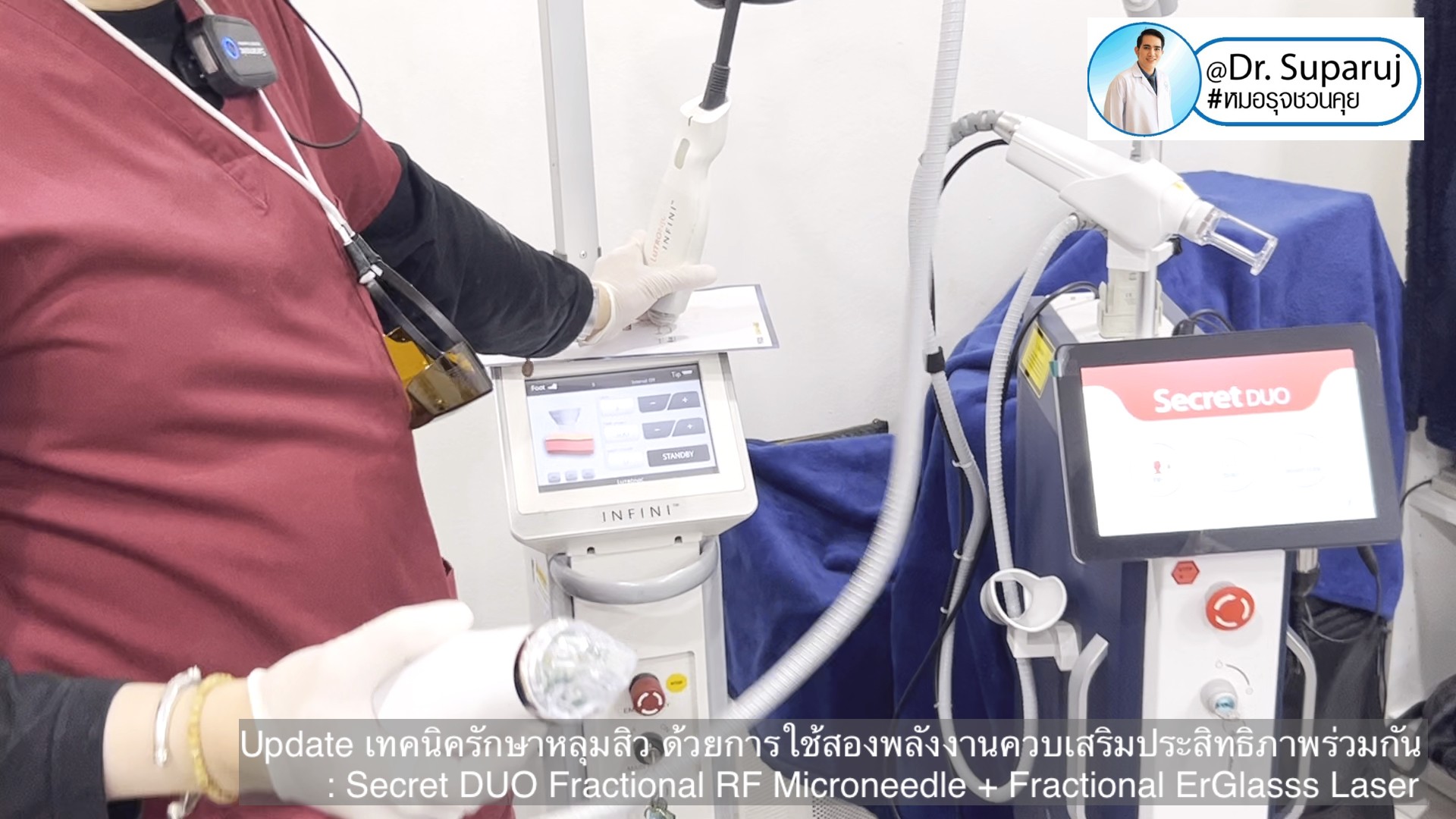 Update เทคนิครักษาหลุมสิว ด้วยการใช้สองพลังงานเสริมประสิทธิภาพร่วมกัน: Secret DUO Fractional RF Microneedle + Fractional ErGlasss Laser