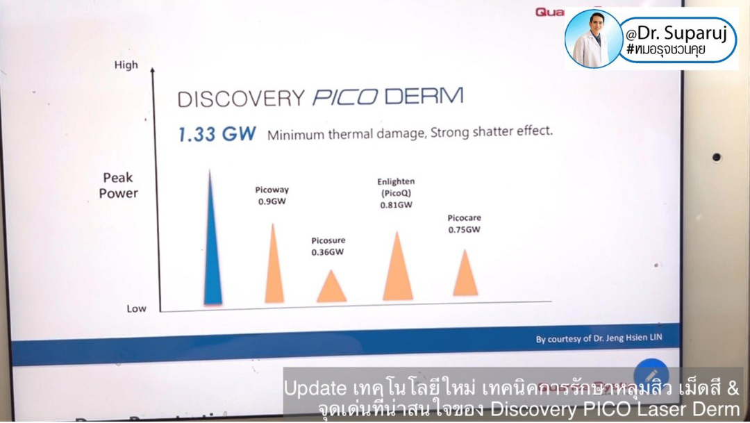 Update Discovery Picosecond Laser จุดเด่น & หลักการทำงาน ใช้ดูแลหลุมสิว แผลเป็น รอยแตกลาย ฝ้า กระจุดด่างดำ ได้อย่างไร ?  Update Discovery Picosecond Laser จุดเด่น & หลักการทำงาน ใช้ดูแลหลุมสิว แผลเป็น รอยแตกลาย ฝ้า กระจุดด่างดำ ได้อย่างไร ?