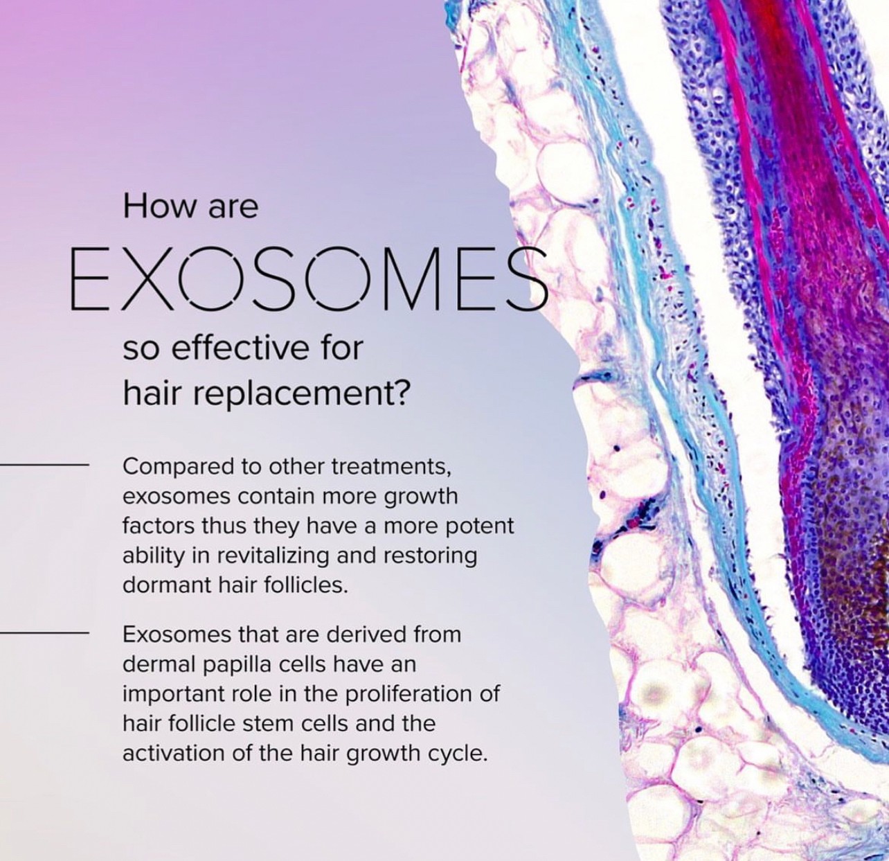 แนะนำเทคนิคดูแลปัญหาผมร่วงผมบาง: Exosome เอ็กโซโซม ช่วยดูแลผมร่วงผมบางได้อย่างไร? แนะนำเทคนิคดูแลปัญหาผมร่วงผมบาง: Exosome เอ็กโซโซม ช่วยดูแลผมร่วงผมบางได้อย่างไร?