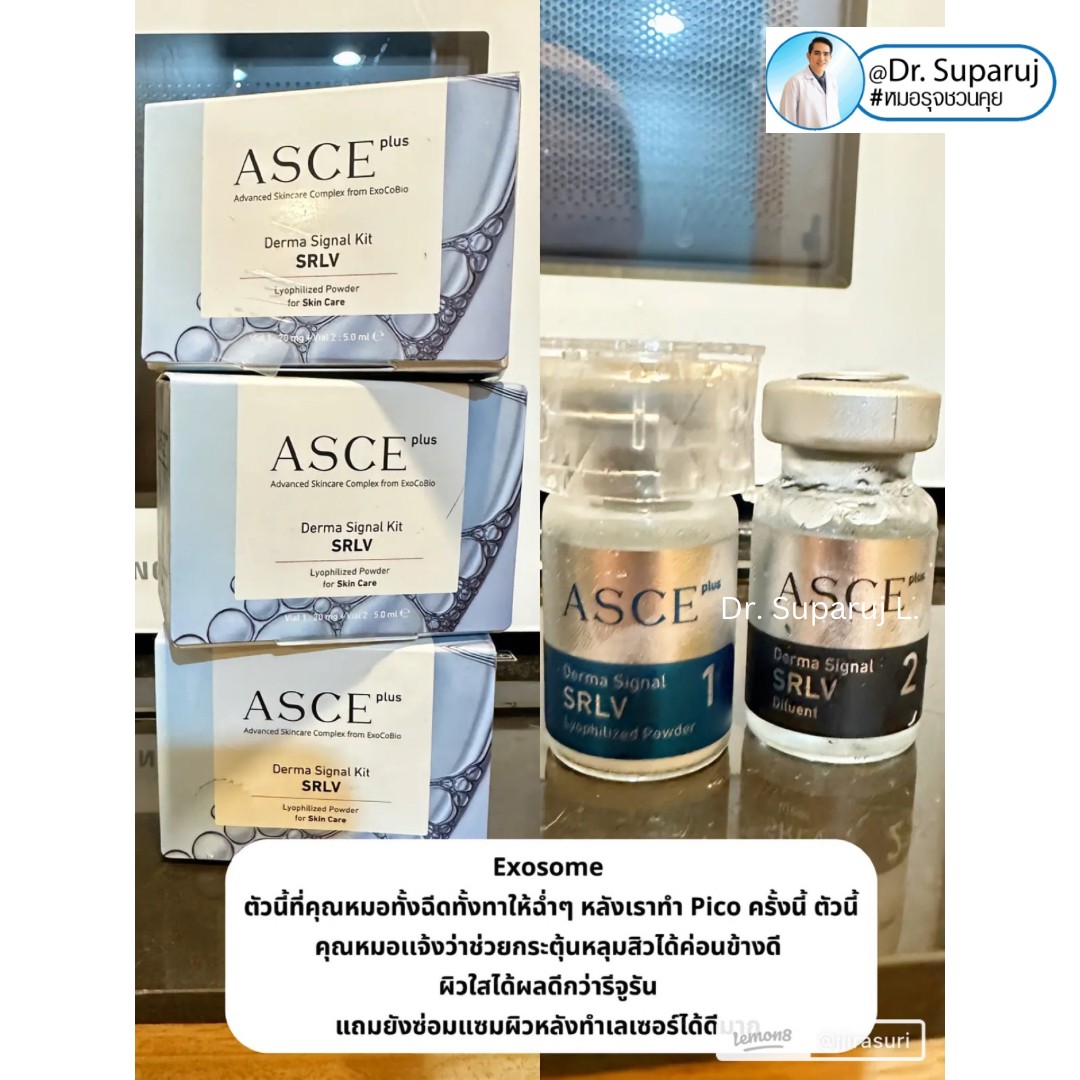 รีวิวรักษาหลุมสิวด้วย Pico Laser +Exosome มันเริดมากแม๊ รีวิวรักษาหลุมสิวด้วย Pico Laser +Exosome มันเริดมากแม๊
