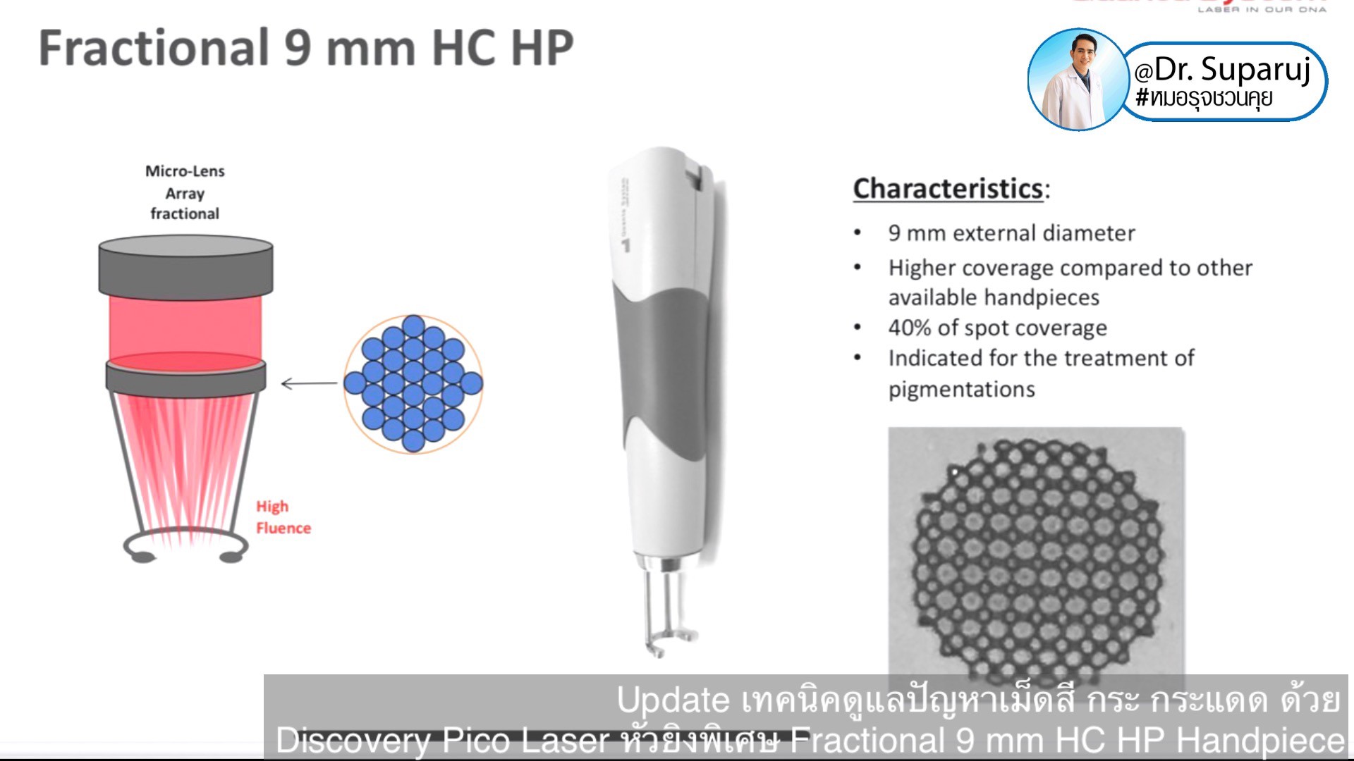 Update เทคนิคดูแลปัญหาเม็ดสี กระ กระแดด ด้วย Discovery Pico Laser หัวยิงเลเซอร์พิเศษ Fractional 9 mm HC HP Handpiece Update เทคนิคดูแลปัญหาเม็ดสี กระ กระแดด ด้วย Discovery Pico Laser หัวยิงเลเซอร์พิเศษ Fractional 9 mm HC HP Handpiece
