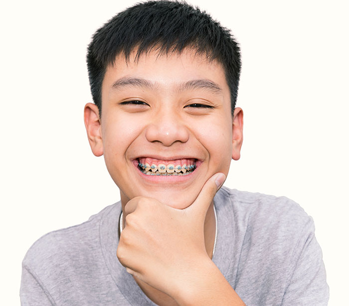 จัดฟัน ขอนแก่น