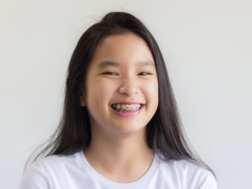 จัดฟัน ขอนแก่น