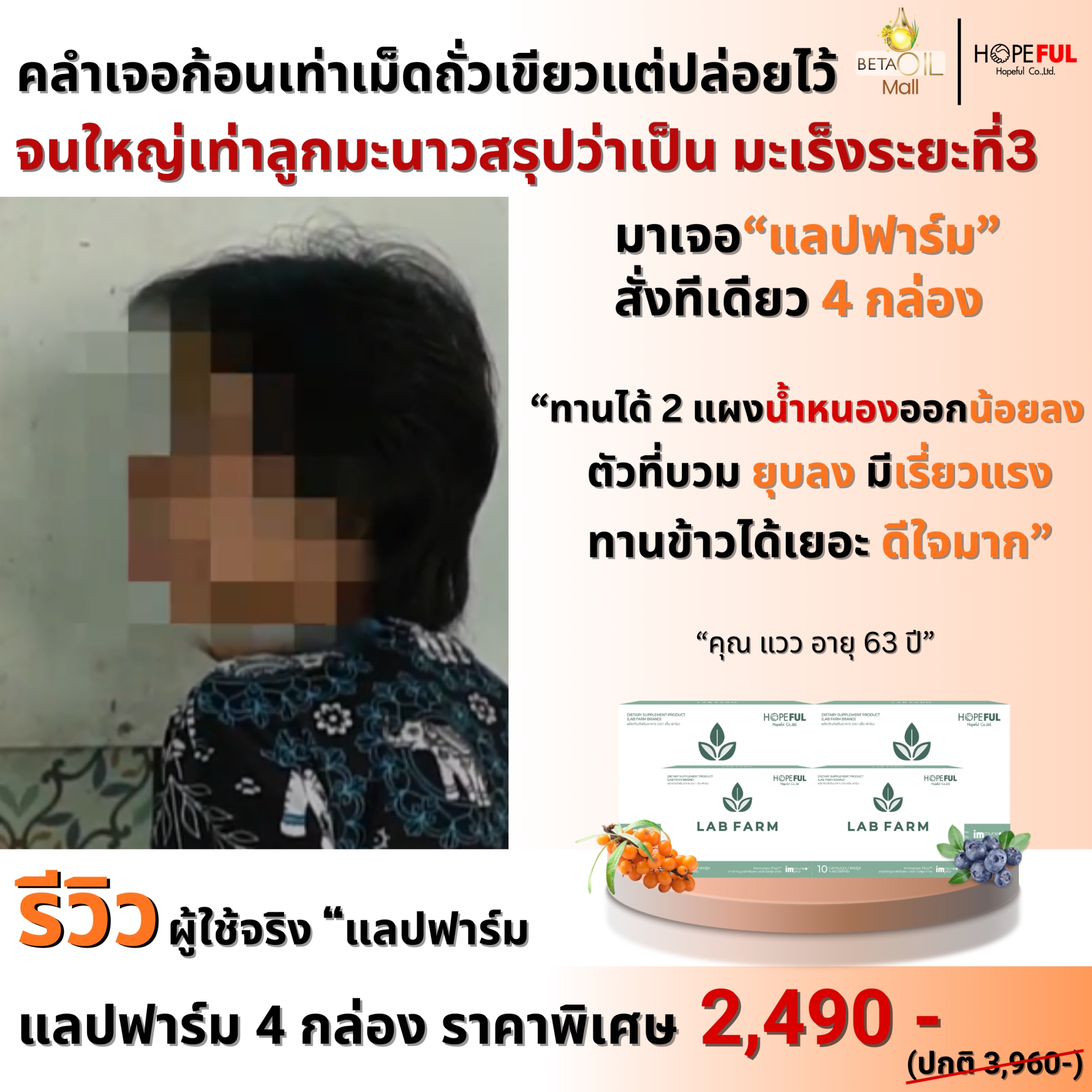 รีวิวแล๊บฟาร์ม