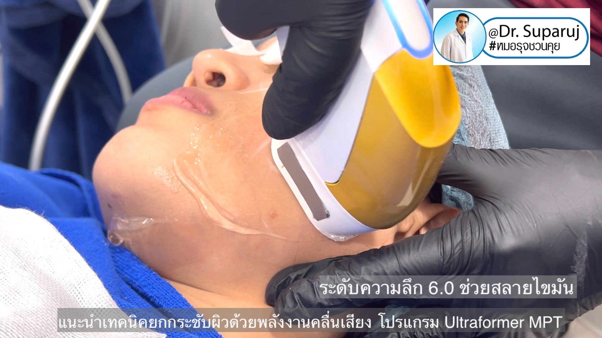 แนะนำเทคนิคยกกระชับผิว ด้วยพลังงานคลื่นเสียง MMFU Focused Ultrasound โปรแกรม Ultraformer MPT