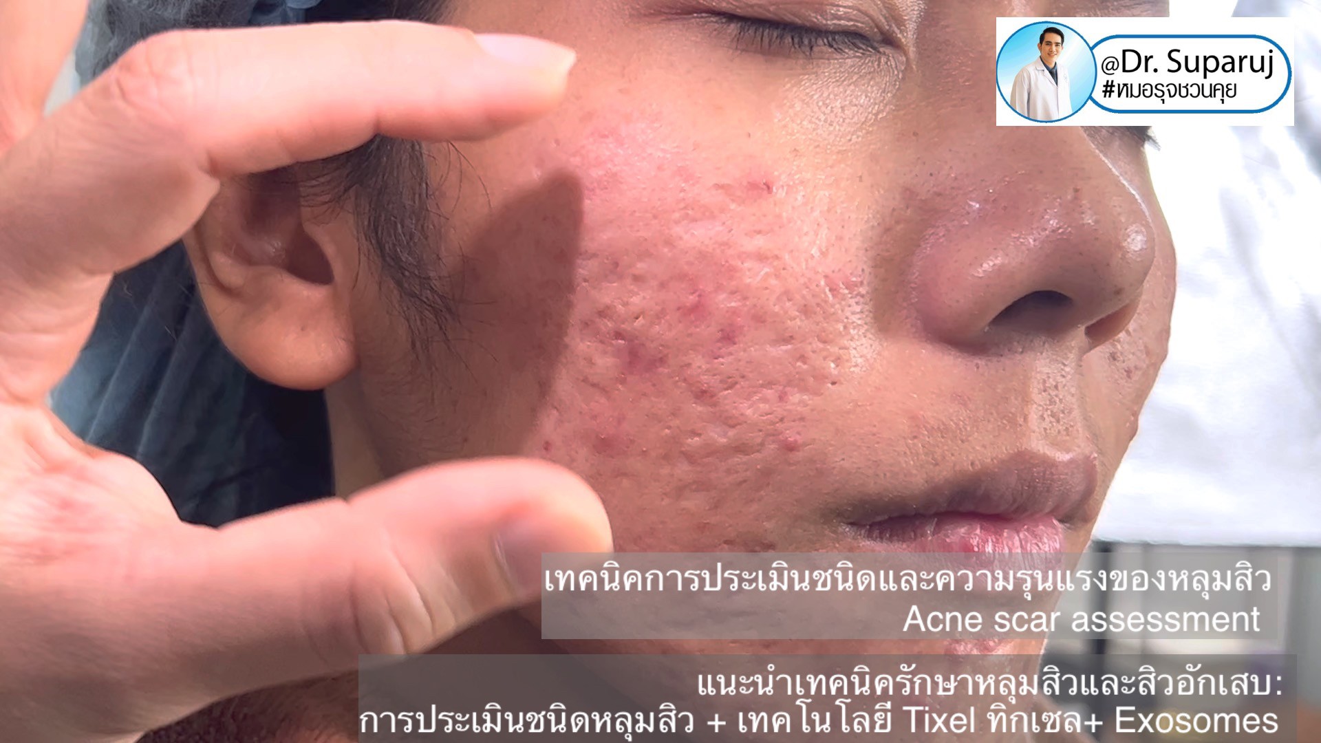 ผลลัพธ์อาจแตกต่างกันไป แล้วแต่บุคคล ผลลัพธ์อาจแตกต่างกันไป แล้วแต่บุคคล