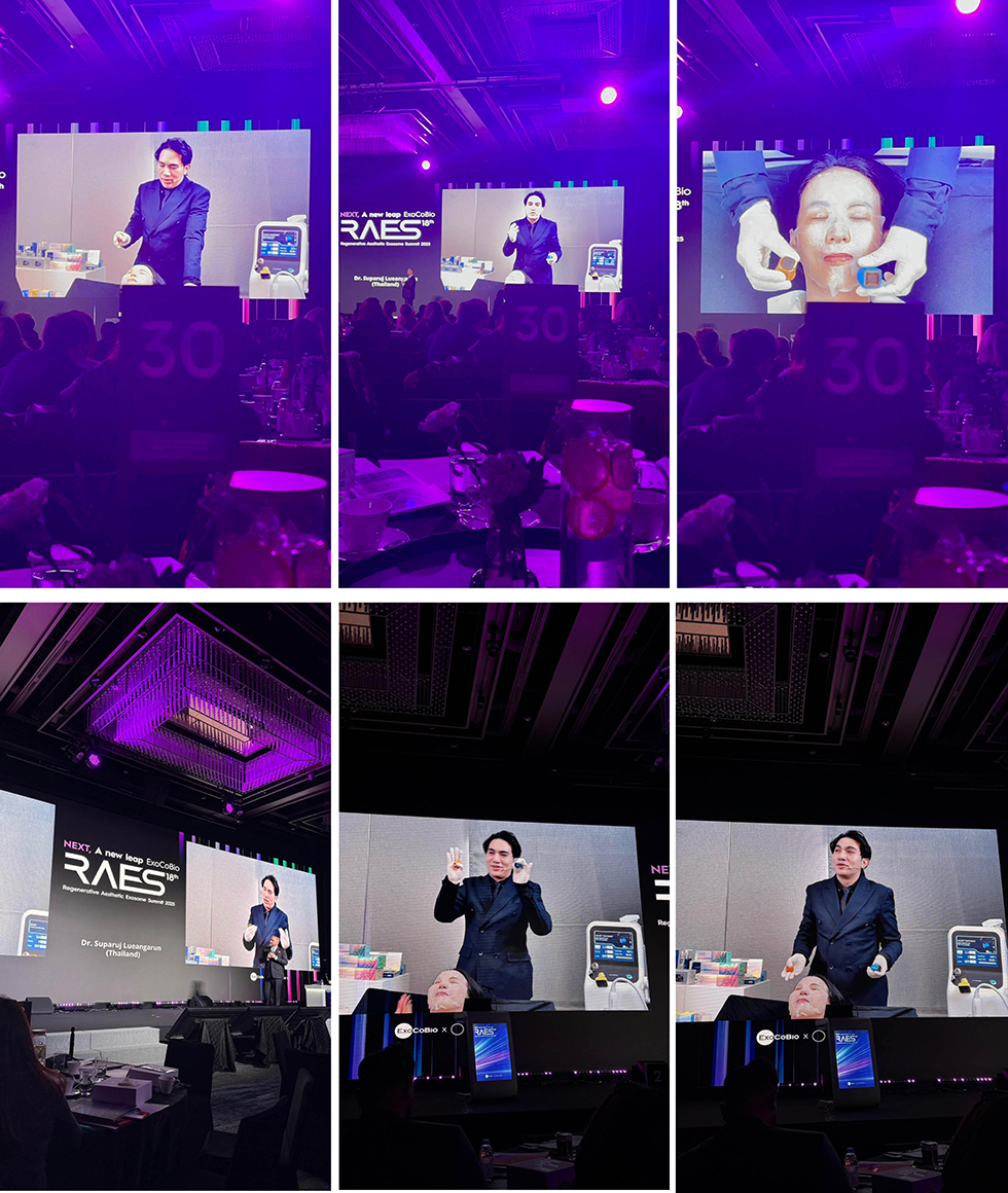 Program Xtherma (TenTherma) for facial tightening Live Demonstration at RAES 2025 conference in Seoul, Korea