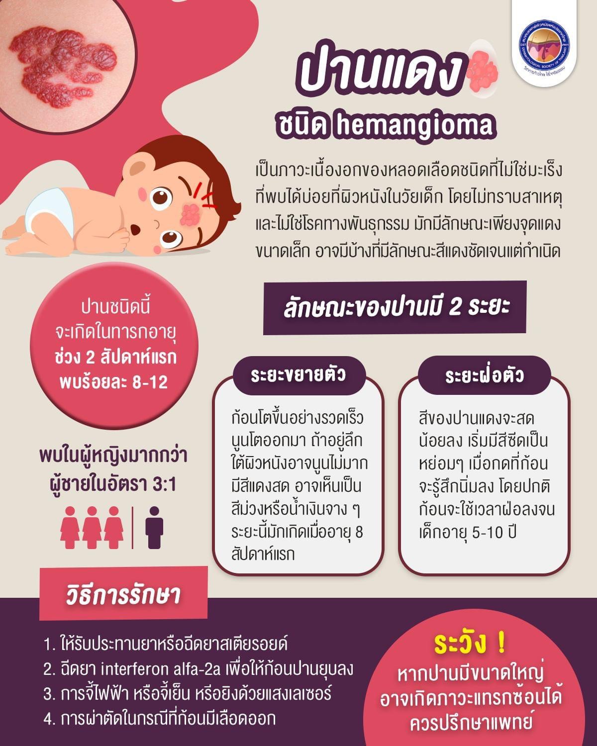 เทคนิคดูแลปานแต่กำเนิดด้วยเลเซอร์ดิสคัฟเวอรี่พิโค Birthmark Treatment with Special Handpieces of Discovery Pico Laser เทคนิคดูแลปานแต่กำเนิดด้วยเลเซอร์ดิสคัฟเวอรี่พิโค Birthmark Treatment with Special Handpieces of Discovery Pico Laser