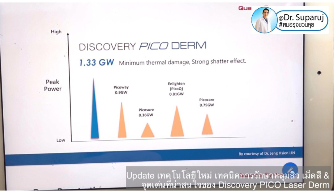 Update เทคโนโลยีใหม่ เทคนิคการรักษาหลุมสิว เม็ดสี & จุดเด่นที่น่าสนใจของ Discovery PICO Laser Derm Update เทคโนโลยีใหม่ เทคนิคการรักษาหลุมสิว เม็ดสี & จุดเด่นที่น่าสนใจของ Discovery PICO Laser Derm