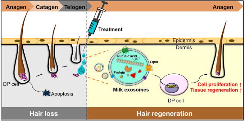 แนะนำเทคนิคดูแลปัญหาผมร่วงผมบาง: Exosome เอ็กโซโซม ช่วยดูแลผมร่วงผมบางได้อย่างไร Exosome Therapy for Hair Loss