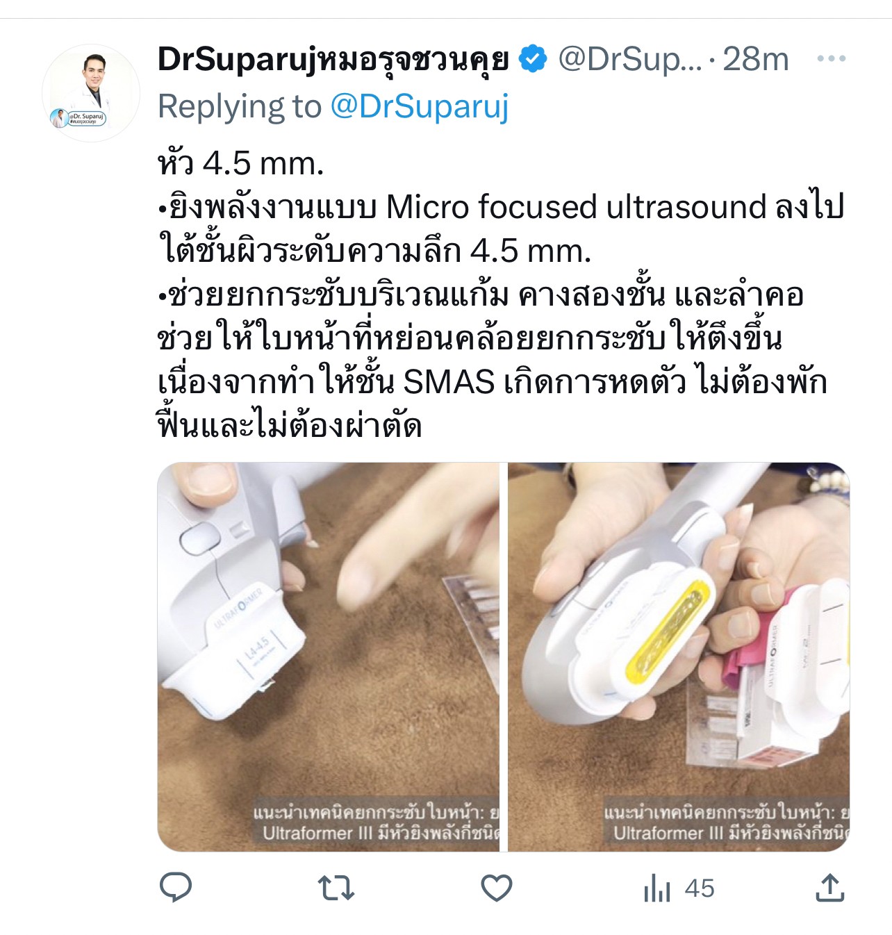 แนะนำเทคนิคยกกระชับใบหน้า: ยกกระชับใบหน้าด้วย Ultraformer III มีหัวยิงพลังกี่ชนิด & ช่วยเรื่องอะไร ? แนะนำเทคนิคยกกระชับใบหน้า: ยกกระชับใบหน้าด้วย Ultraformer III มีหัวยิงพลังกี่ชนิด & ช่วยเรื่องอะไร ?