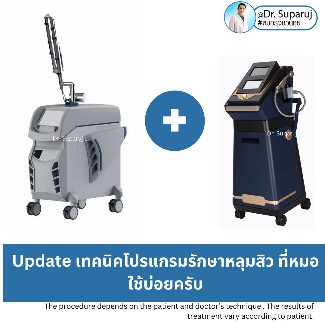 เทคนิคโปรแกรมรักษาหลุมสิว ที่หมอใช้บ่อยครับ เทคนิคโปรแกรมรักษาหลุมสิว ที่หมอใช้บ่อยครับ