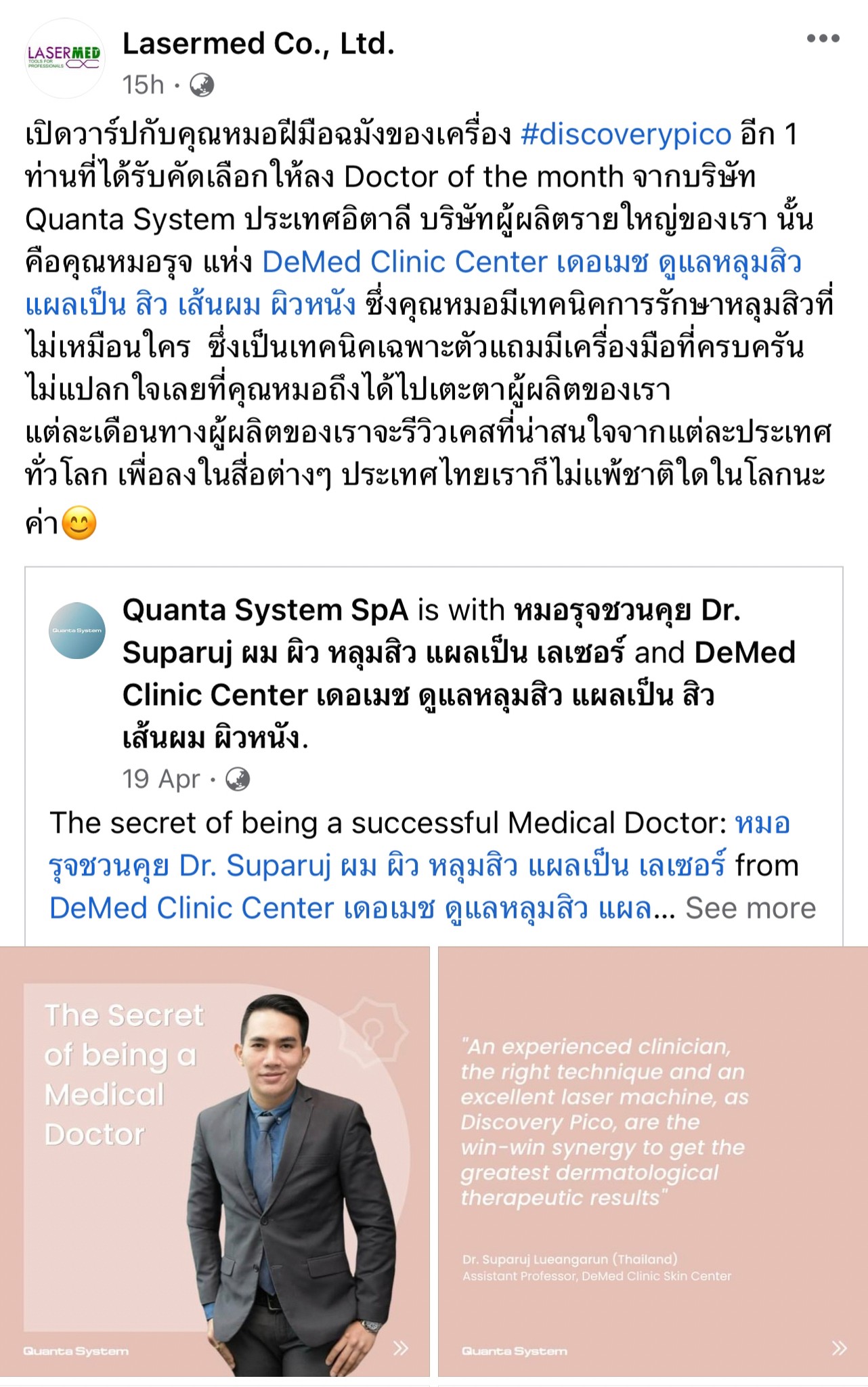 เทคนิคหลักการรักษาหลุมสิวด้วยเลเซอร์ Diacovery Pico Laser ของหมอรุจได้รับการเผยแพร่ในระดับนานาชาติของทางบริษัทระดับโลก Quanta System จากประเทศอิตาลีครับ เทคนิคหลักการรักษาหลุมสิวด้วยเลเซอร์ Diacovery Pico Laser ของหมอรุจได้รับการเผยแพร่ในระดับนานาชาติของทางบริษัทระดับโลก Quanta System จากประเทศอิตาลีครับ