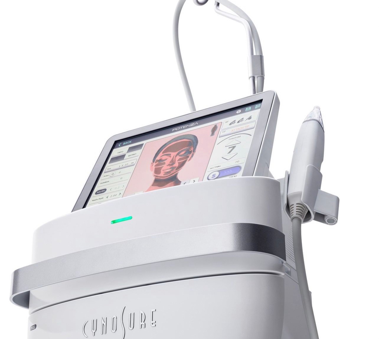 Update นวัตกรรมยกกระชับผิว ดูแลหลุมสิว ลดริ้วรอย: Potenza RF Microneedling โพเทนซ่า Update นวัตกรรมยกกระชับผิว ดูแลหลุมสิว ลดริ้วรอย: Potenza RF Microneedling โพเทนซ่า