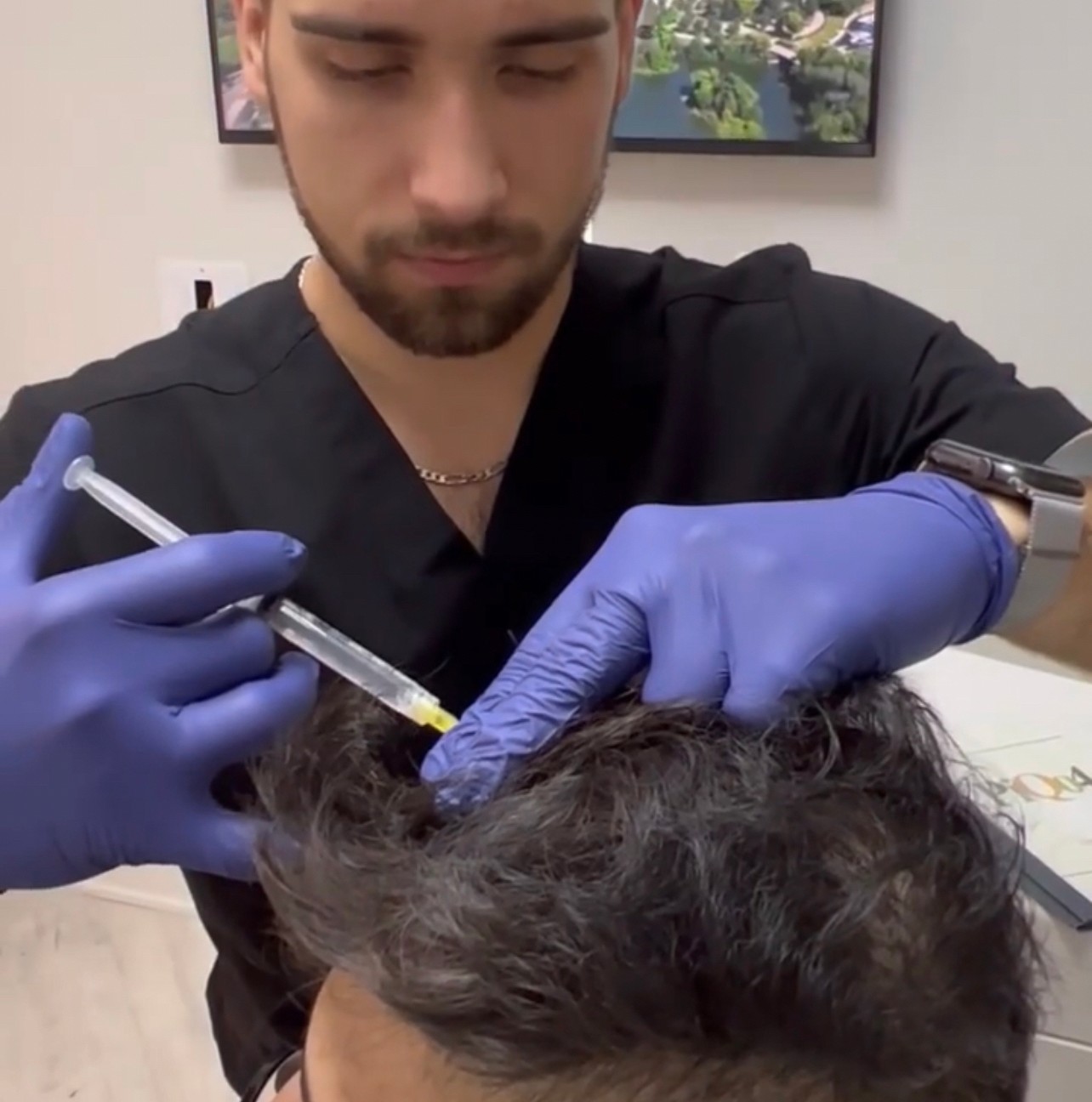 แนะนำเทคนิคดูแลปัญหาผมร่วงผมบาง: Exosome เอ็กโซโซม ช่วยดูแลผมร่วงผมบางได้อย่างไร? แนะนำเทคนิคดูแลปัญหาผมร่วงผมบาง: Exosome เอ็กโซโซม ช่วยดูแลผมร่วงผมบางได้อย่างไร?