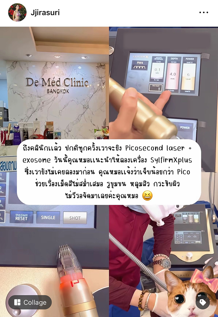 นอกใจโปรแกรมเลเซอร์ Pico ลองของใหม่ โปรแกรม SylfirmXplus ขอบคุณรีวิวดูแลหลุมสิวด้วยโปรแกรม SylfirmX Plus จากคุณจูนครับ