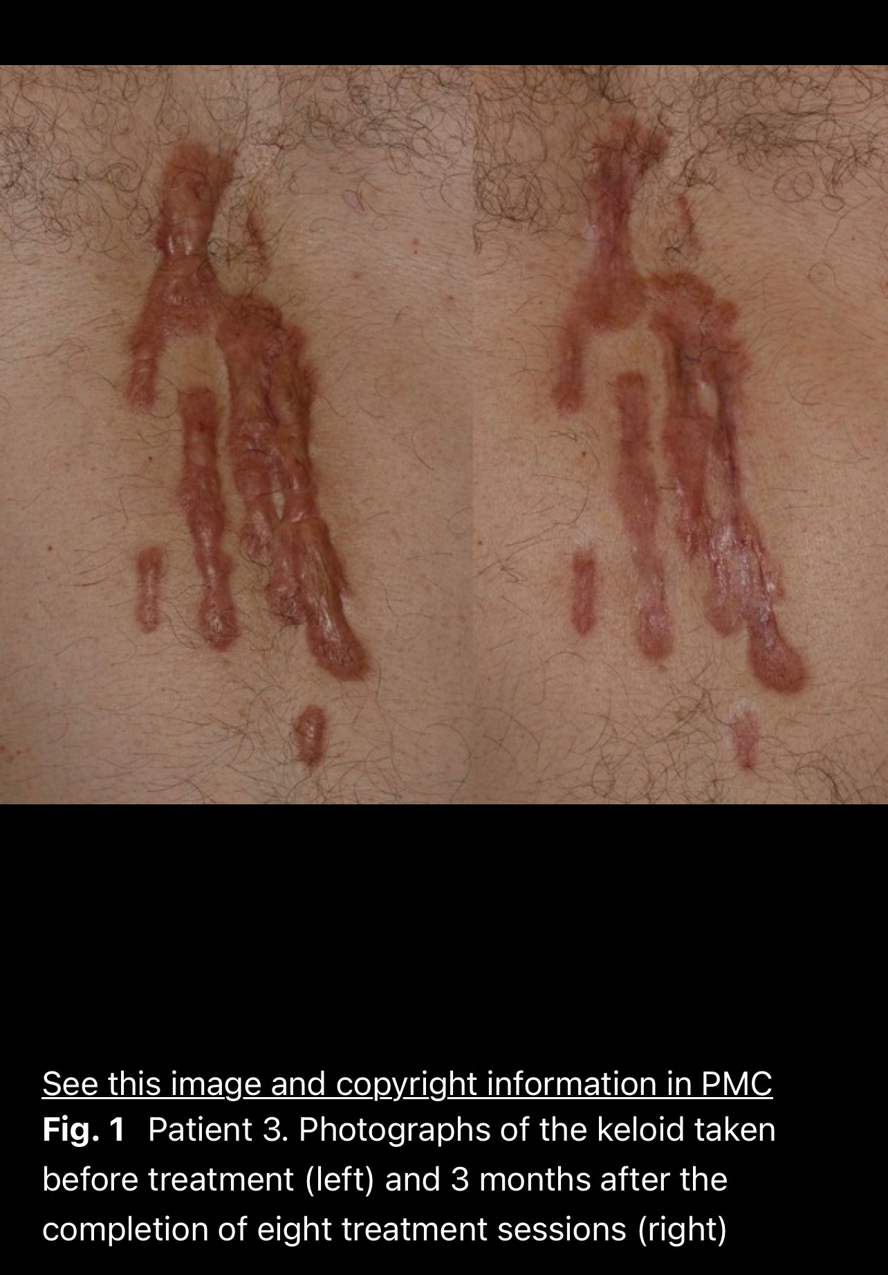 ผลลัพธ์อาจแตกต่างกันไป แล้วแต่บุคคล ผลลัพธ์อาจแตกต่างกันไป แล้วแต่บุคคล