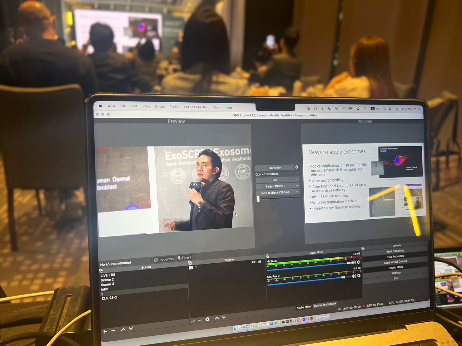 ผศ.นพ. ศุภะรุจ เลื่องอรุณ (หมอรุจ) ได้รับเชิญเป็นวิทยากร แชร์เทคนิคๆการดูแลหลุมสิว แผลเป็น ผมร่วงผมบางด้วยการใช้ Exosomes ในงานสัมมนา The Aesthetic Secret of Exosome based on Scientific Data ผศ.นพ. ศุภะรุจ เลื่องอรุณ (หมอรุจ) ได้รับเชิญเป็นวิทยากร แชร์เทคนิคๆการดูแลหลุมสิว แผลเป็น ผมร่วงผมบางด้วยการใช้ Exosomes ในงานสัมมนา The Aesthetic Secret of Exosome based on Scientific Data