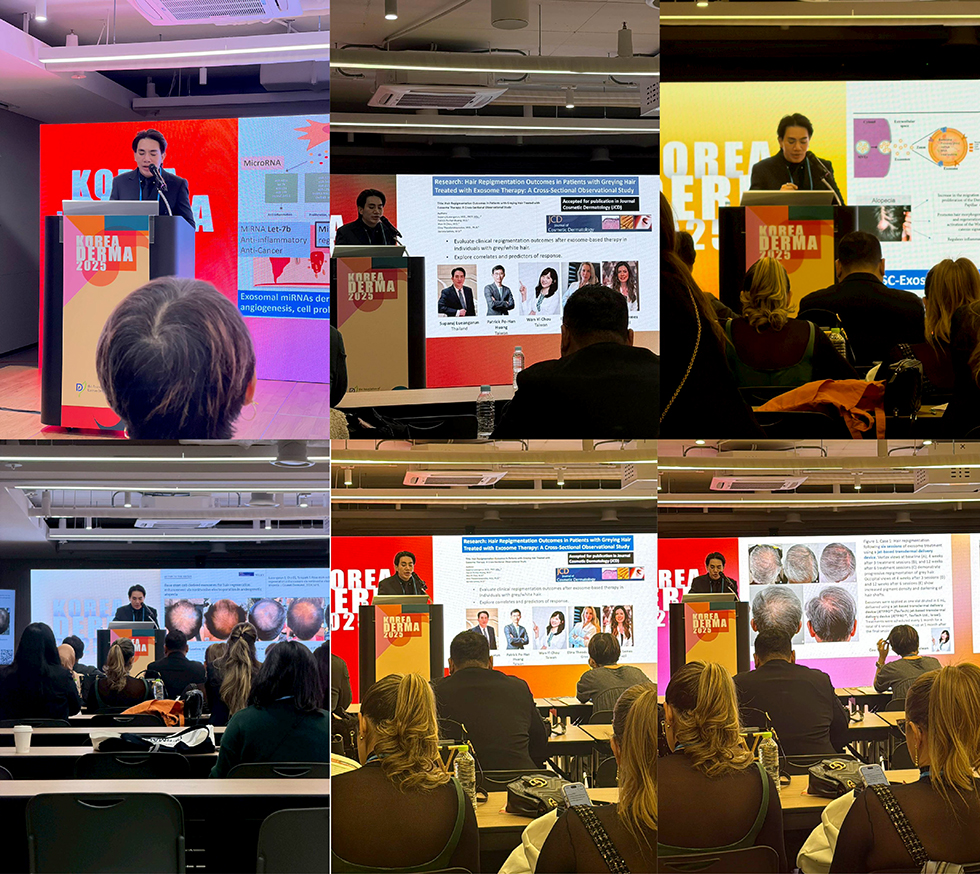 Hair Loss and Hair Repigmentation at Korea Derma 2025 Congress in Seoul, Korea Hair Loss and Hair Repigmentation at Korea Derma 2025 Congress in Seoul, Korea