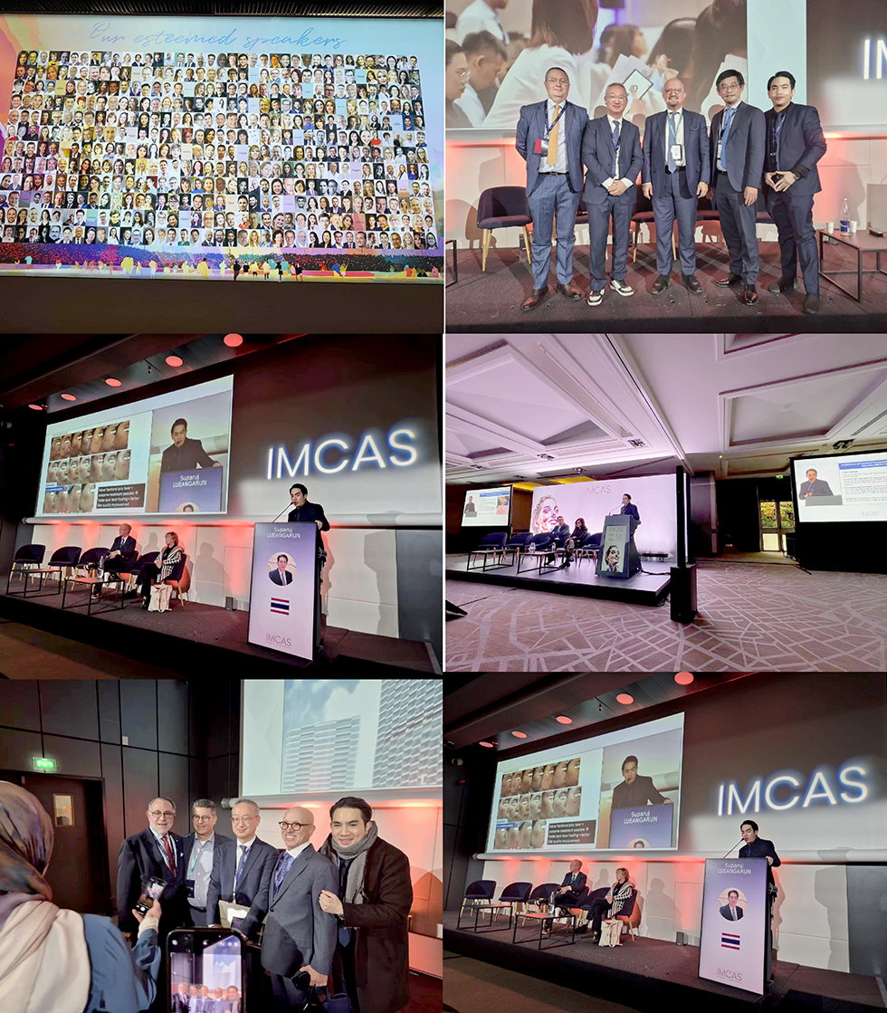 หมอรุจนำเสนอผลงานวิจัย ด้านการรักษาหลุมสิว ในงานประชุมวิชาการ IMCAS World Congress 2025