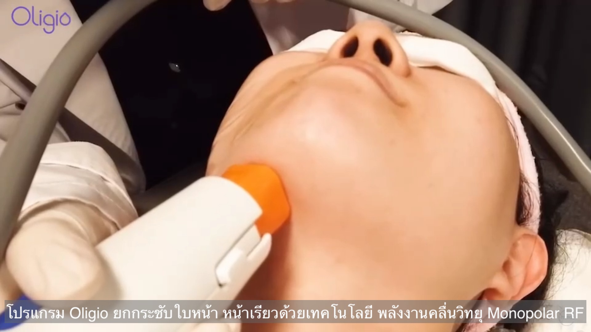 ยกกระชับผิวหน้าด้วย โปรแกรม Oligio Monopolar RF มีกลไก& จุดเด่น อย่างไร ? ยกกระชับผิวหน้าด้วย โปรแกรม Oligio Monopolar RF มีกลไก& จุดเด่น อย่างไร ?