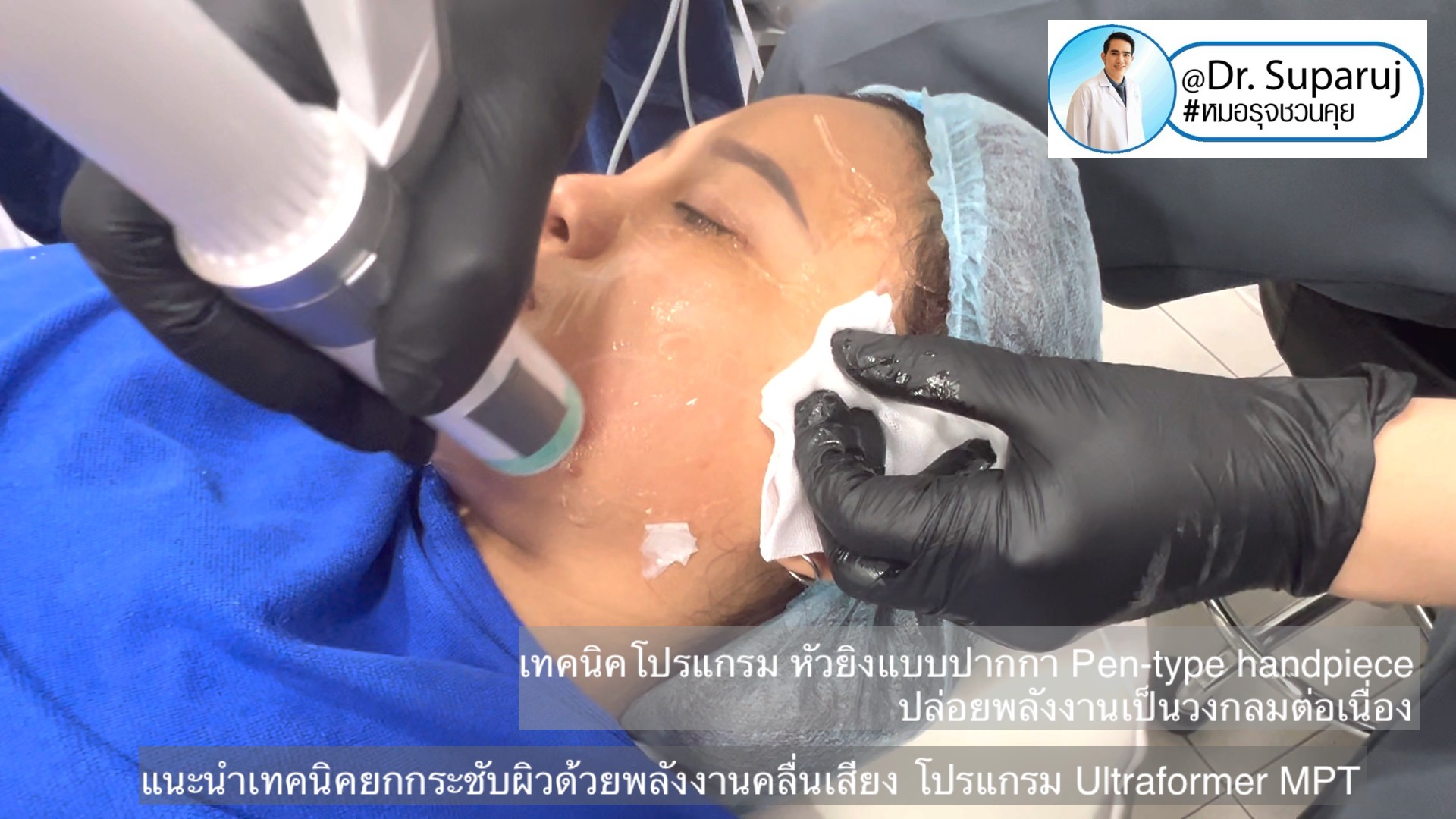 แนะนำเทคนิคยกกระชับผิว ด้วยพลังงานคลื่นเสียง MMFU Focused Ultrasound โปรแกรม Ultraformer MPT