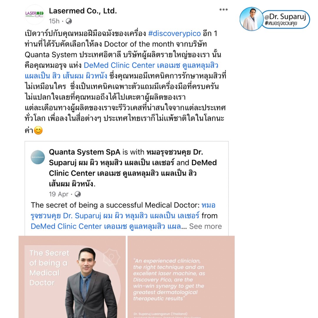 เทคนิคหลักการรักษาหลุมสิวด้วยเลเซอร์ Diacovery Pico Laser ของหมอรุจได้รับการเผยแพร่ในระดับนานาชาติของทางบริษัทระดับโลก Quanta System จากประเทศอิตาลีครับ เทคนิคหลักการรักษาหลุมสิวด้วยเลเซอร์ Diacovery Pico Laser ของหมอรุจได้รับการเผยแพร่ในระดับนานาชาติของทางบริษัทระดับโลก Quanta System จากประเทศอิตาลีครับ