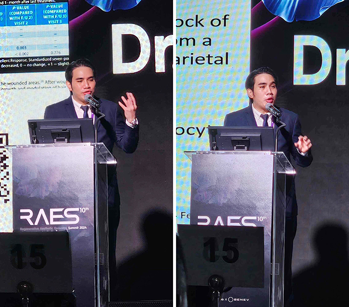 ผศ. นพ. ศุภะรุจ เลื่องอรุณ รู้สึกเป็นเกียรติอย่างมากที่ได้มีโอกาสร่วมบรรยายและได้รับรางวัลจากงานประชุมวิชาการด้าน Extracellular vesicle: RAES 2024 ครั้งที่ 10 (Regenerative Aesthetic Exosome Summit Korea 2024) ณ กรุงโซล ประเทศเกาหลีใต้ 2024 ที่กรุงโซล ประเทศเกาหลี ผศ. นพ. ศุภะรุจ เลื่องอรุณ รู้สึกเป็นเกียรติอย่างมากที่ได้มีโอกาสร่วมบรรยายและได้รับรางวัลจากงานประชุมวิชาการด้าน Extracellular vesicle: RAES 2024 ครั้งที่ 10 (Regenerative Aesthetic Exosome Summit Korea 2024) ณ กรุงโซล ประเทศเกาหลีใต้ 2024 ที่กรุงโซล ประเทศเกาหลี