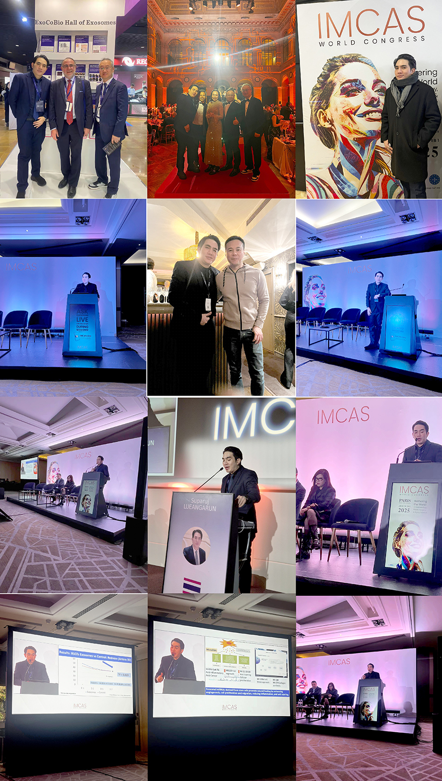 หมอรุจนำเสนอผลงานวิจัย ด้านการรักษาหลุมสิว ในงานประชุมวิชาการ IMCAS World Congress 2025 หมอรุจนำเสนอผลงานวิจัย ด้านการรักษาหลุมสิว ในงานประชุมวิชาการ IMCAS World Congress 2025