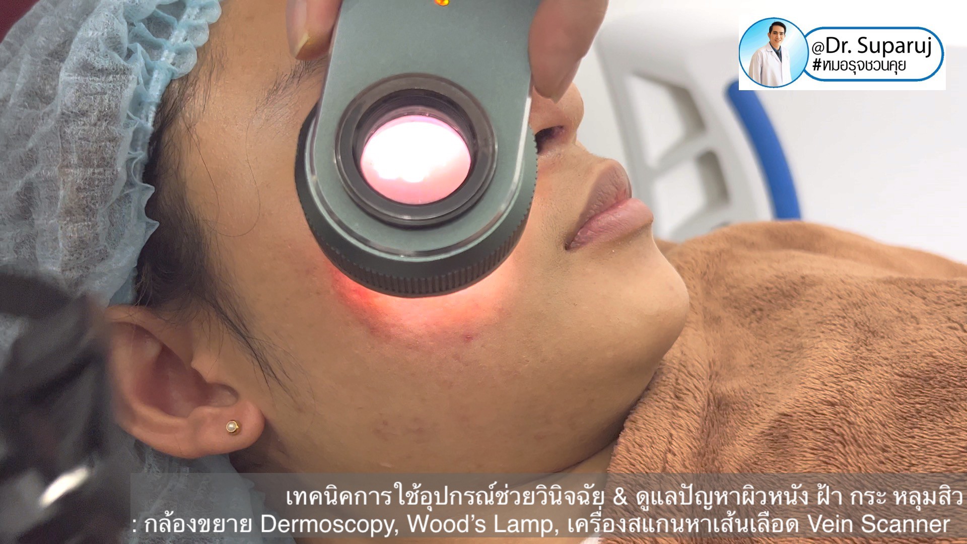 เทคนิคการใช้อุปกรณ์ช่วยวินิจฉัย & ดูแลปัญหาผิวหนัง ฝ้า กระ หลุมสิว: กล้องขยาย Dermoscopy, แว่นขยายพร้อมแสงในช่วงUV: Wood’s Lamp, เครื่องสแกนหาเส้นเลือด Vein Scanner เทคนิคการใช้อุปกรณ์ช่วยวินิจฉัย & ดูแลปัญหาผิวหนัง ฝ้า กระ หลุมสิว: กล้องขยาย Dermoscopy, แว่นขยายพร้อมแสงในช่วงUV: Wood’s Lamp, เครื่องสแกนหาเส้นเลือด Vein Scanner