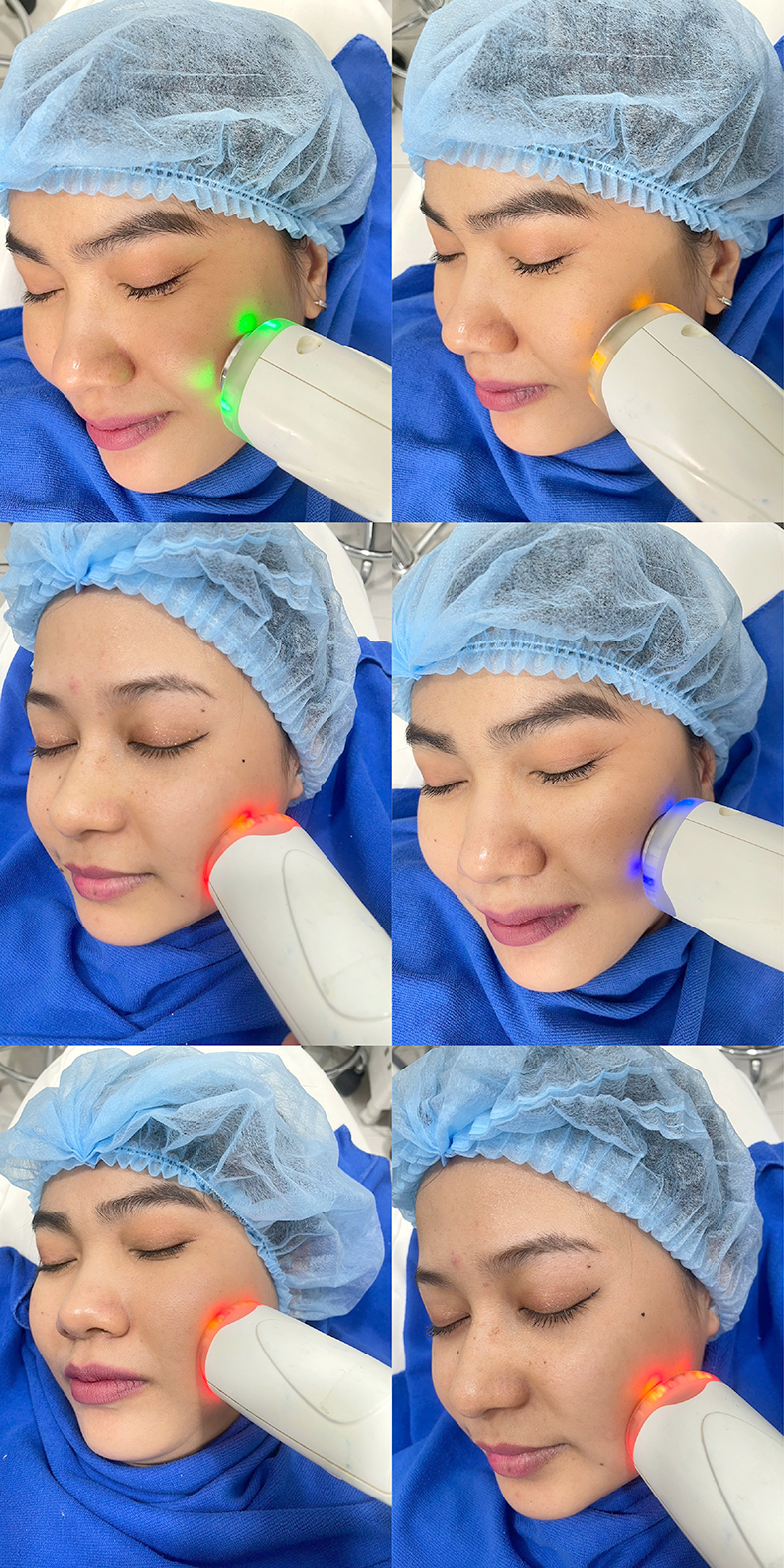 โปรแกรม PORA COOL + Skin Radiant Treatment โพล่าร์คูล + สกินเรเดียน ทรีทเมนท์ หน้ากระจ่างใส ลดการอักเสบของผิว ลดสิว โปรแกรม PORA COOL + Skin Radiant Treatment โพล่าร์คูล + สกินเรเดียน ทรีทเมนท์ หน้ากระจ่างใส ลดการอักเสบของผิว ลดสิว