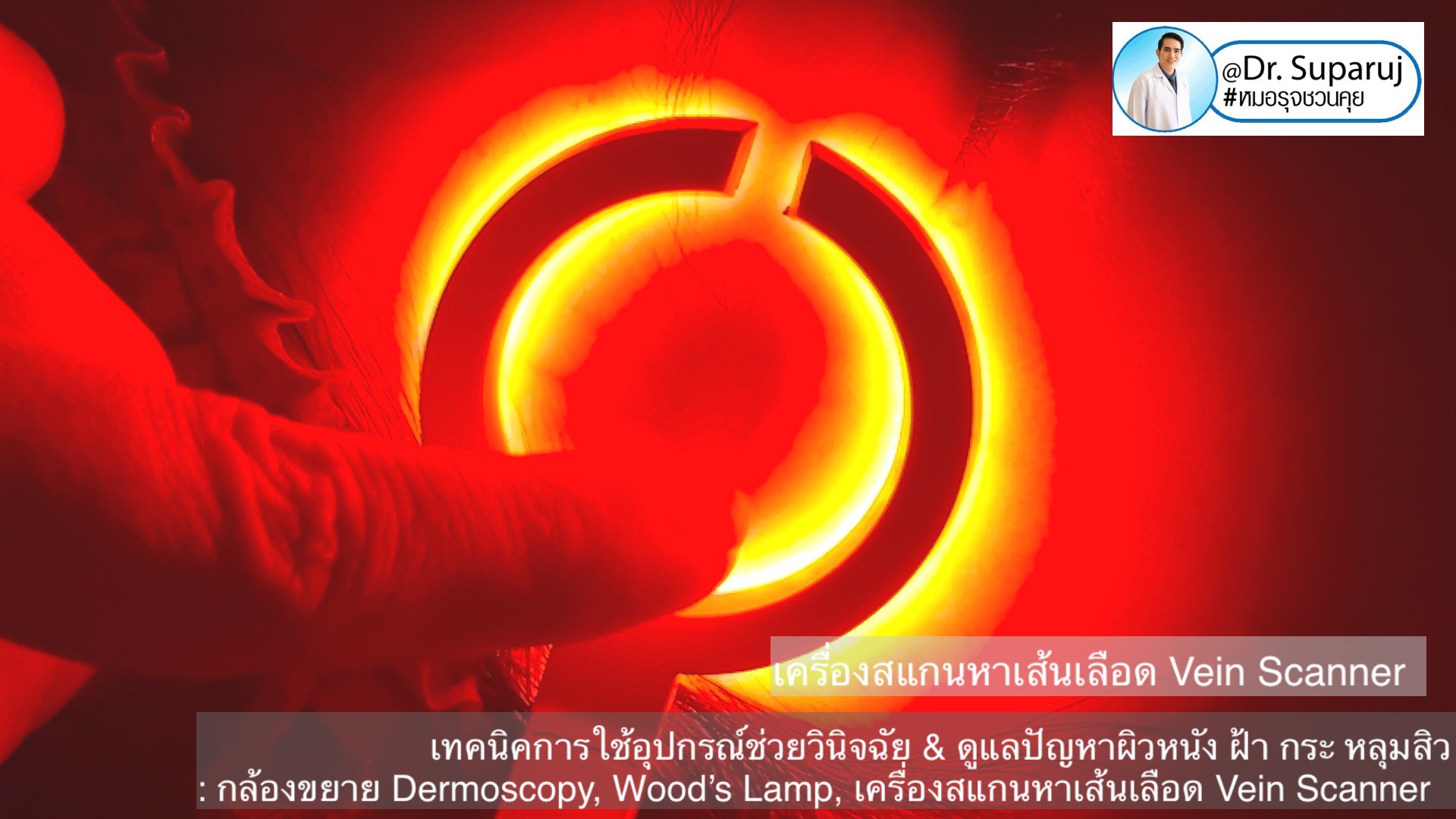 เทคนิคการใช้อุปกรณ์ช่วยวินิจฉัย & ดูแลปัญหาผิวหนัง ฝ้า กระ หลุมสิว: กล้องขยาย Dermoscopy, แว่นขยายพร้อมแสงในช่วงUV: Wood’s Lamp, เครื่องสแกนหาเส้นเลือด Vein Scanner เทคนิคการใช้อุปกรณ์ช่วยวินิจฉัย & ดูแลปัญหาผิวหนัง ฝ้า กระ หลุมสิว: กล้องขยาย Dermoscopy, แว่นขยายพร้อมแสงในช่วงUV: Wood’s Lamp, เครื่องสแกนหาเส้นเลือด Vein Scanner