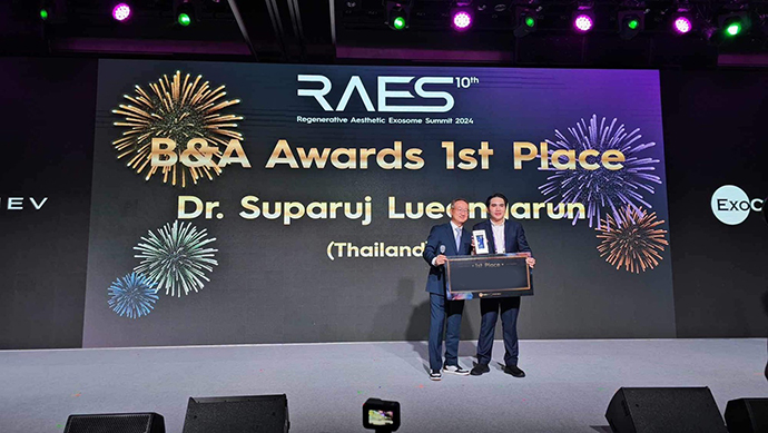 ผศ. นพ. ศุภะรุจ เลื่องอรุณ รู้สึกเป็นเกียรติอย่างมากที่ได้มีโอกาสร่วมบรรยายและได้รับรางวัลจากงานประชุมวิชาการด้าน Extracellular vesicle: RAES 2024 ครั้งที่ 10 (Regenerative Aesthetic Exosome Summit Korea 2024) ณ กรุงโซล ประเทศเกาหลีใต้ 2024 ที่กรุงโซล ประเทศเกาหลี ผศ. นพ. ศุภะรุจ เลื่องอรุณ รู้สึกเป็นเกียรติอย่างมากที่ได้มีโอกาสร่วมบรรยายและได้รับรางวัลจากงานประชุมวิชาการด้าน Extracellular vesicle: RAES 2024 ครั้งที่ 10 (Regenerative Aesthetic Exosome Summit Korea 2024) ณ กรุงโซล ประเทศเกาหลีใต้ 2024 ที่กรุงโซล ประเทศเกาหลี