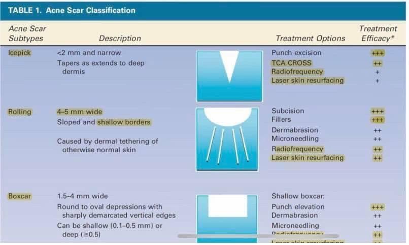 Update เทคนิครักษาหลุมสิว: หลุมสิวแบบจิกลึก Ice Pick Acne Scar มีลักษณะ & ดูแลได้อย่างไร ?