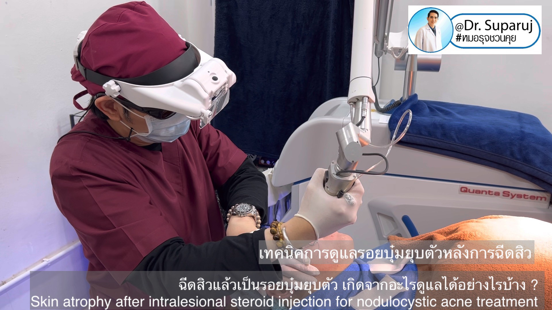 ฉีดสิวแล้วเป็นรอยบุ๋มยุบตัว เกิดจากอะไรดูแลได้อย่างไรบ้าง ? (Skin atrophy after intralesional steroid injection for nodulocystic acne treatment ) ฉีดสิวแล้วเป็นรอยบุ๋มยุบตัว เกิดจากอะไรดูแลได้อย่างไรบ้าง ? (Skin atrophy after intralesional steroid injection for nodulocystic acne treatment )