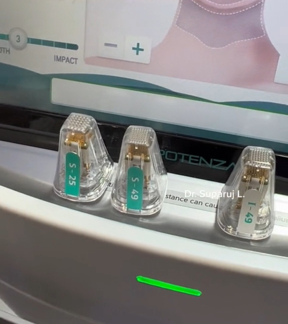 Update นวัตกรรมยกกระชับผิว ดูแลหลุมสิว ลดริ้วรอย: Potenza RF Microneedling โพเทนซ่า Update นวัตกรรมยกกระชับผิว ดูแลหลุมสิว ลดริ้วรอย: Potenza RF Microneedling โพเทนซ่า